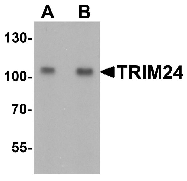 TRIM24 / TIF1 Antibody - Western blot analysis of TRIM24 in EL4 cell lysate with TRIM24 antibody at (A) 0.5 and (B) 1 ug/ml.