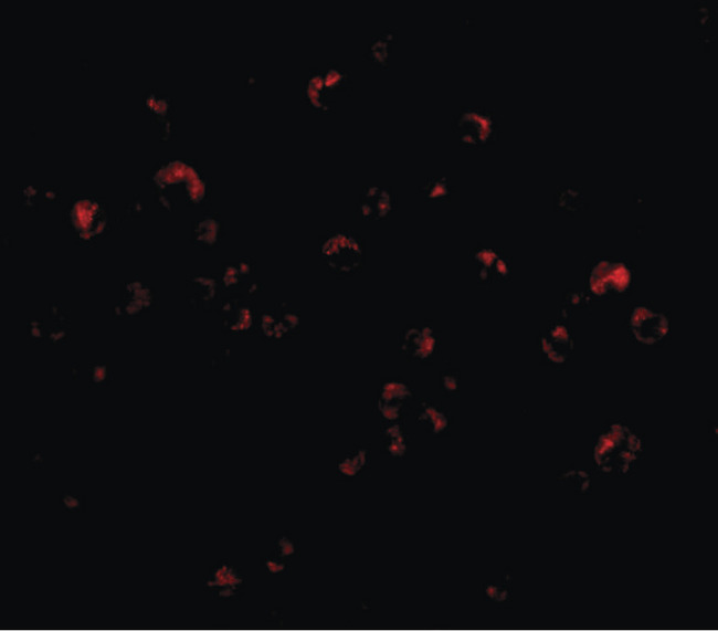 TRIM25 Antibody - Immunofluorescence of TRIM25 in HeLa cells with TRIM25 antibody at 20 ug/ml.