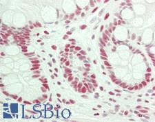 TRIM28 / KAP1 Antibody - Human Small Intestine: Formalin-Fixed, Paraffin-Embedded (FFPE)