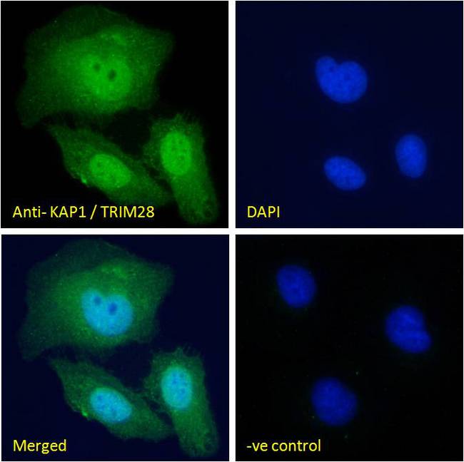 TRIM28 / KAP1 Antibody - TRIM28 / KAP1 antibody immunofluorescence analysis of paraformaldehyde fixed U2OS cells, permeabilized with 0.15% Triton. Primary incubation 1hr (10ug/ml) followed by Alexa Fluor 488 secondary antibody (2ug/ml), showing nuclear staining. The nuclear stain is DAPI (blue). Negative control: Unimmunized goat IgG (10ug/ml) followed by Alexa Fluor 488 secondary antibody (2ug/ml).