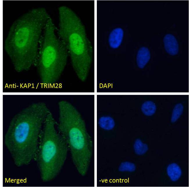 TRIM28 / KAP1 Antibody - TRIM28 / KAP1 antibody immunofluorescence analysis of paraformaldehyde fixed HeLa cells, permeabilized with 0.15% Triton. Primary incubation 1hr (10ug/ml) followed by Alexa Fluor 488 secondary antibody (2ug/ml), showing nuclear staining. The nuclear stain is DAPI (blue). Negative control: Unimmunized goat IgG (10ug/ml) followed by Alexa Fluor 488 secondary antibody (2ug/ml).