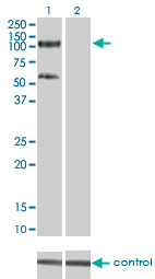 TRIM28 / KAP1 Antibody - Western blot of TRIM28 over-expressed 293 cell line, cotransfected with TRIM28 Validated Chimera RNAi (Lane 2) or non-transfected control (Lane 1). Blot probed with TRIM28 monoclonal antibody clone 4E6. GAPDH ( 36.1 kD ) used as control.