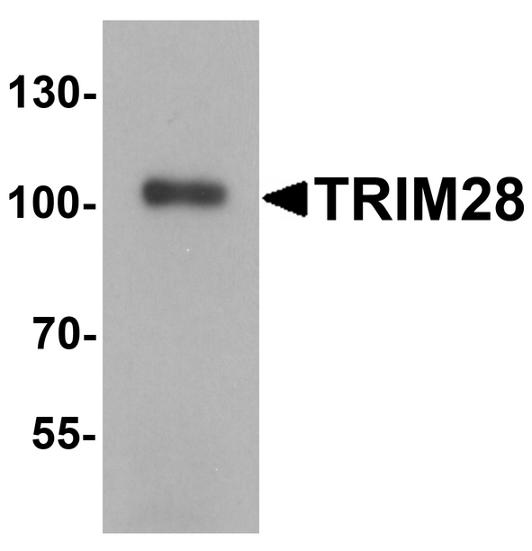 TRIM28 / KAP1 Antibody - Western blot analysis of TRIM28 in human testis tissue lysate with TRIM28 antibody at 1 ug/ml.