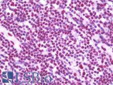 TRIM28 / KAP1 Antibody - Anti-TRIM28 / KAP-1 antibody IHC staining of human tonsil. Immunohistochemistry of formalin-fixed, paraffin-embedded tissue after heat-induced antigen retrieval. Antibody concentration 10 ug/ml.