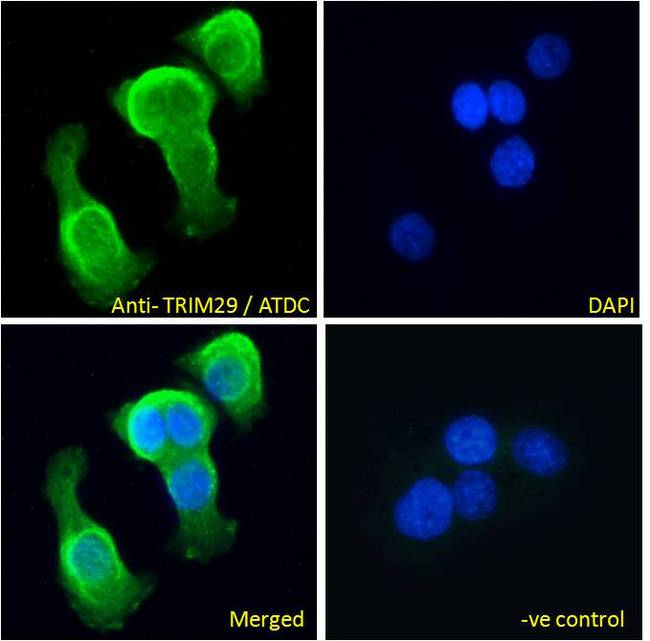 TRIM29 Antibody - TRIM29 / ATDC antibody immunofluorescence analysis of paraformaldehyde fixed A431 cells, permeabilized with 0.15% Triton. Primary incubation 1hr (10ug/ml) followed by Alexa Fluor 488 secondary antibody (2ug/ml), showing vesicle staining. The nuclear stain is DAPI (blue).