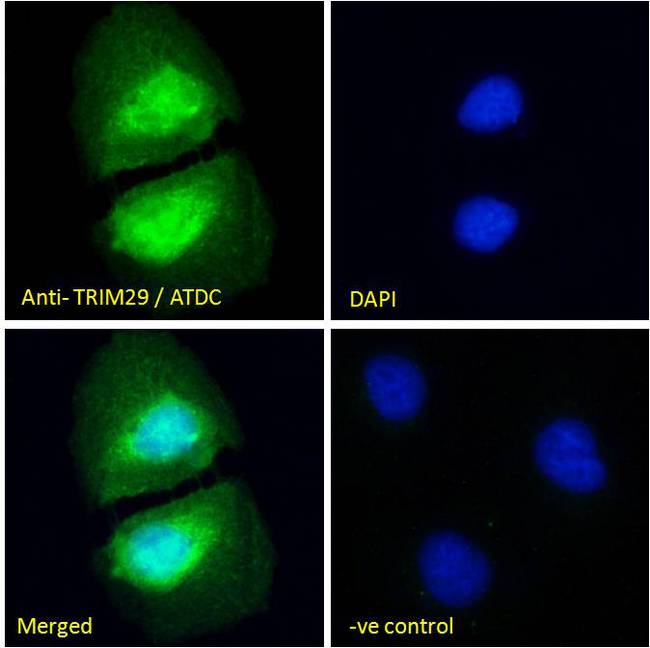 TRIM29 Antibody - TRIM29 / ATDC antibody immunofluorescence analysis of paraformaldehyde fixed U2OS cells, permeabilized with 0.15% Triton. Primary incubation 1hr (10ug/ml) followed by Alexa Fluor 488 secondary antibody (4ug/ml), showing nuclear staining. The nuclear stain is DAPI (blue). Negative control: Unimmunized goat IgG (10ug/ml) followed by Alexa Fluor 488 secondary antibody (2ug/ml).