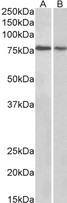 TRIM3 Antibody - Goat Anti-BERP / RNF22 Antibody (0.3µg/ml) staining of Human Cerebellum (A) and Rat (B) Brain lysate (35µg protein in RIPA buffer). Primary incubation was 1 hour. Detected by chemiluminescencence