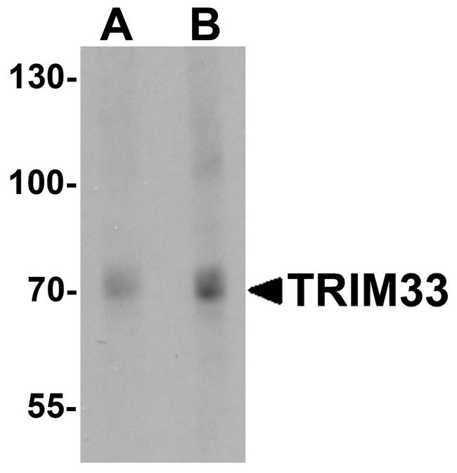 TRIM33 / TIF1-Gamma Antibody - Western blot analysis of TRIM33 in human liver tissue lysate with TRIM33 antibody at (A) 1 and (B) 2 ug/ml.