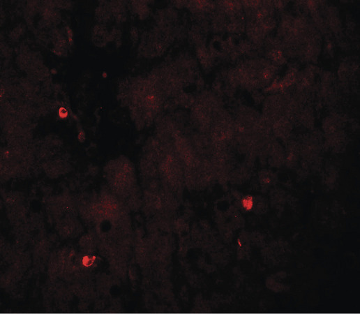 TRIM33 / TIF1-Gamma Antibody - Immunofluorescence of TRIM33 in human liver tissue with TRIM33 antibody at 20 ug/ml.