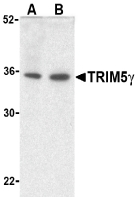 TRIM5 Antibody - Western blot of TRIM5g expression in human bladder (A) and colon (B) cell lysate with TRIM5g antibody at 2 ug /ml.