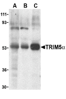 TRIM5 Antibody - Western blot of TRIM5a expression in human stomach (A), thymus (B), and uterus (C) cell lysate with TRIM5a antibody at 2 ug /ml.