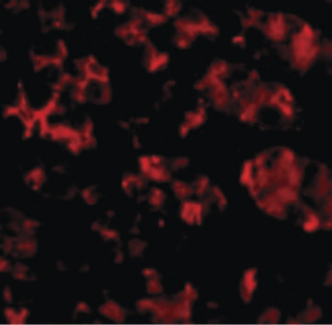 TRIM5 Antibody - Immunofluorescence of TRIM5 alpha in Human Stomach cells with TRIM5 alpha antibody at 10 ug/ml.