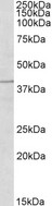 TRIM5 Antibody - Goat Anti-TRIM5 / RNF88 Antibody (2µg/ml) staining of Human Placenta lysate (35µg protein in RIPA buffer). Detected by chemiluminescencence.