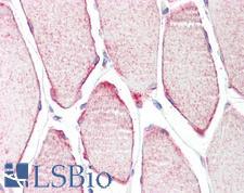 TRIM54 / MURF Antibody - Anti-TRIM54 / MURF antibody IHC staining of human skeletal muscle. Immunohistochemistry of formalin-fixed, paraffin-embedded tissue after heat-induced antigen retrieval.