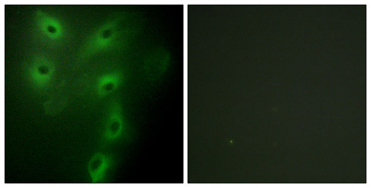 TRIM59 Antibody - Immunofluorescence analysis of HeLa cells, using TRIM59 Antibody. The picture on the right is blocked with the synthesized peptide.