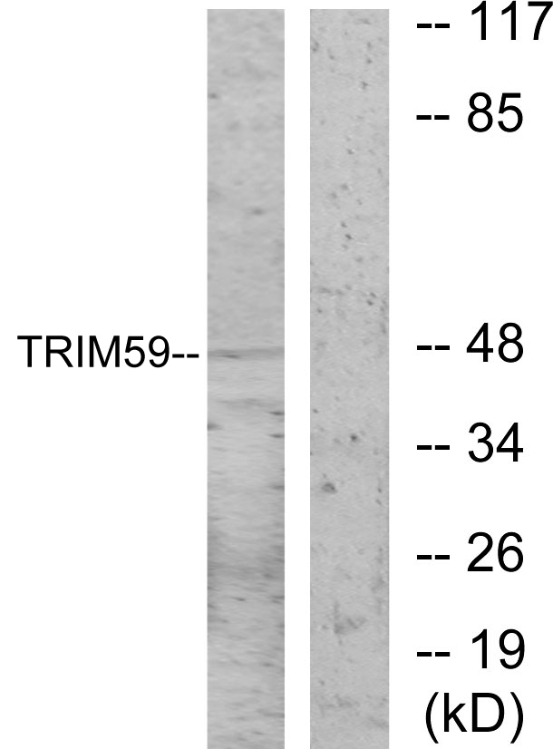 TRIM59 Antibody - Western blot analysis of lysates from NIH/3T3 cells, using TRIM59 Antibody. The lane on the right is blocked with the synthesized peptide.