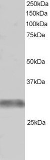 TRIM7 Antibody - Antibody staining (1 ug/ml) of Human Muscle lysate (RIPA buffer, 30 ug total protein per lane). Primary incubated for 1 hour. Detected by Western blot of chemiluminescence.