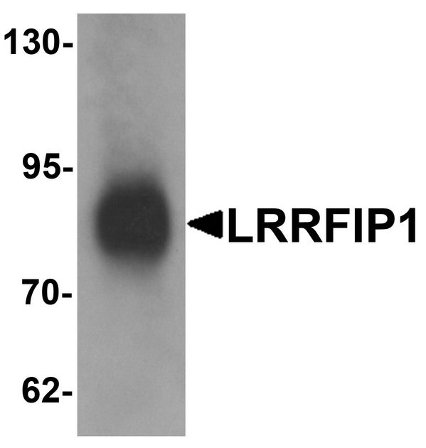 TRIP / LRRFIP1 Antibody - Western blot analysis of LRRFIP1 in human colon tissue lysate with LRRFIP1 antibody at 1 ug/ml.