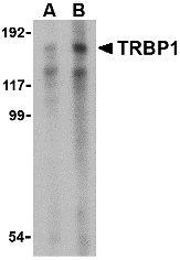 TRM3 / TARBP1 Antibody - Western blot analysis of TRBP1 in 3T3 cell lysate with TRBP1 antibody at (A) 1 and (B) 2 ug/ml.