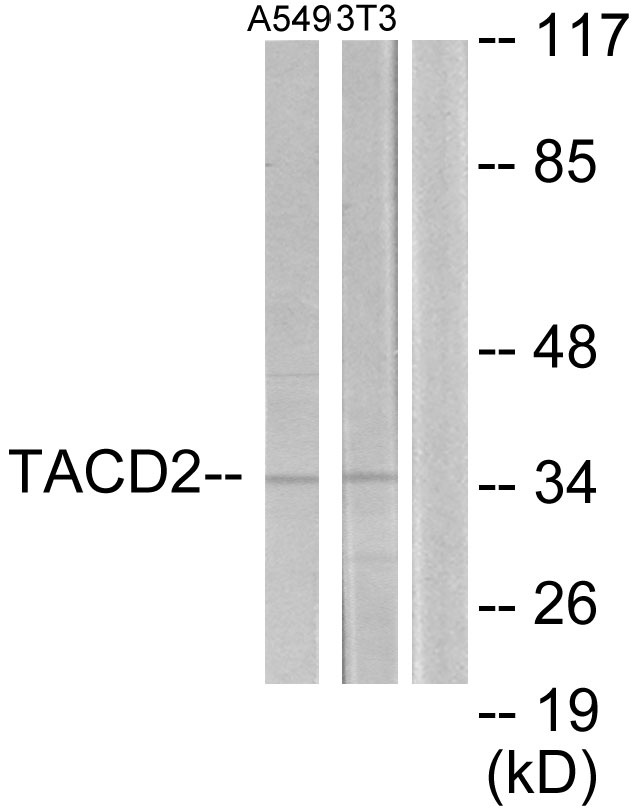 TROP2 / TACSTD2 Antibody - Western blot analysis of lysates from A549 and NIH/3T3 cells, using TACD2 Antibody. The lane on the right is blocked with the synthesized peptide.