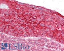 TROP2 / TACSTD2 Antibody - Anti-TROP2 antibody IHC of human tonsil. Immunohistochemistry of formalin-fixed, paraffin-embedded tissue after heat-induced antigen retrieval. Antibody concentration 2.5 ug/ml.