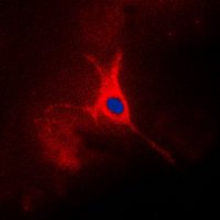 TROP2 / TACSTD2 Antibody - Immunofluorescent analysis of TACSTD2 staining in A549 cells. Formalin-fixed cells were permeabilized with 0.1% Triton X-100 in TBS for 5-10 minutes and blocked with 3% BSA-PBS for 30 minutes at room temperature. Cells were probed with the primary antibody in 3% BSA-PBS and incubated overnight at 4 deg C in a humidified chamber. Cells were washed with PBST and incubated with a DyLight 594-conjugated secondary antibody (red) in PBS at room temperature in the dark. DAPI was used to stain the cell nuclei (blue).