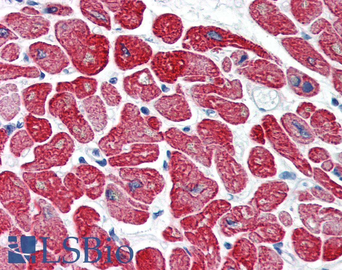 Tropomyosin Antibody - Anti-Tropomyosin antibody IHC of human heart. Immunohistochemistry of formalin-fixed, paraffin-embedded tissue after heat-induced antigen retrieval. Antibody concentration 5 ug/ml.