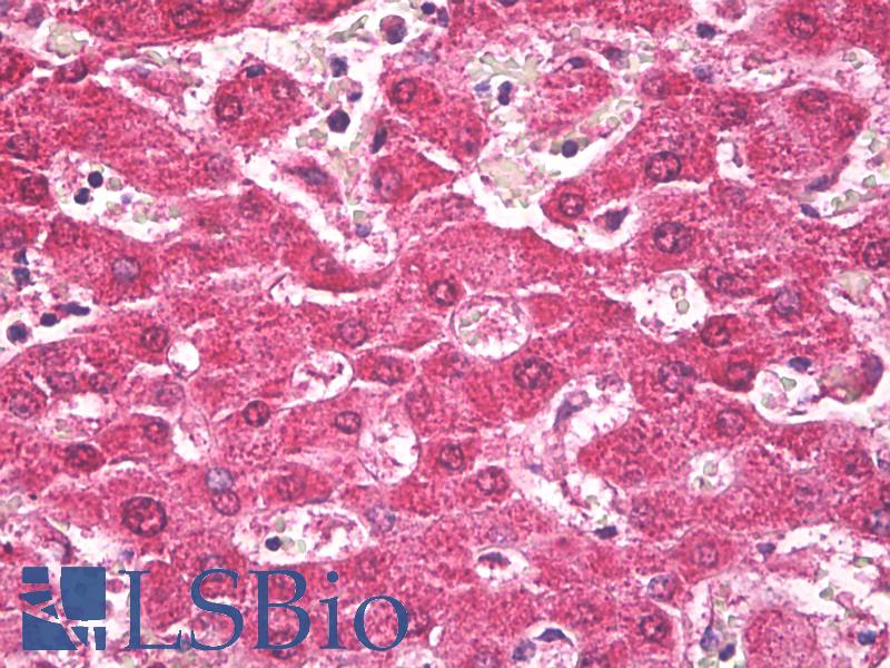 TROVE2 Antibody - Anti-TROVE2 antibody IHC of human liver. Immunohistochemistry of formalin-fixed, paraffin-embedded tissue after heat-induced antigen retrieval. Antibody dilution 1:100.