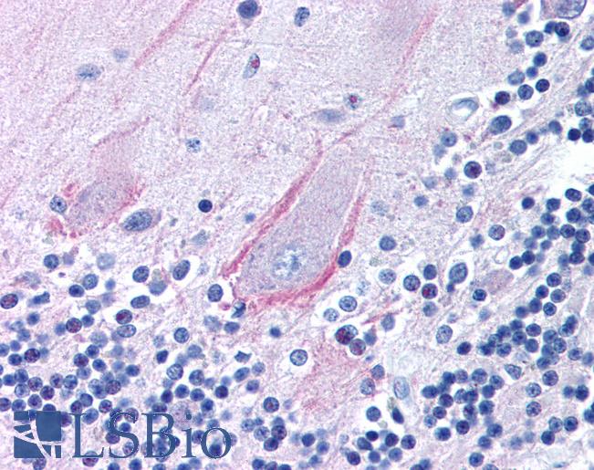 TRPA1 Antibody - TRPA1 antibody (5 ug/ml) was used in IHC to stain formalin-fixed, paraffin-embedded human brain, cerebellum, followed by biotinylated goat anti-rabbit IgG secondary antibody, alkaline phosphatase-streptavidin and chromogen.  This image was taken for the unconjugated form of this product. Other forms have not been tested.