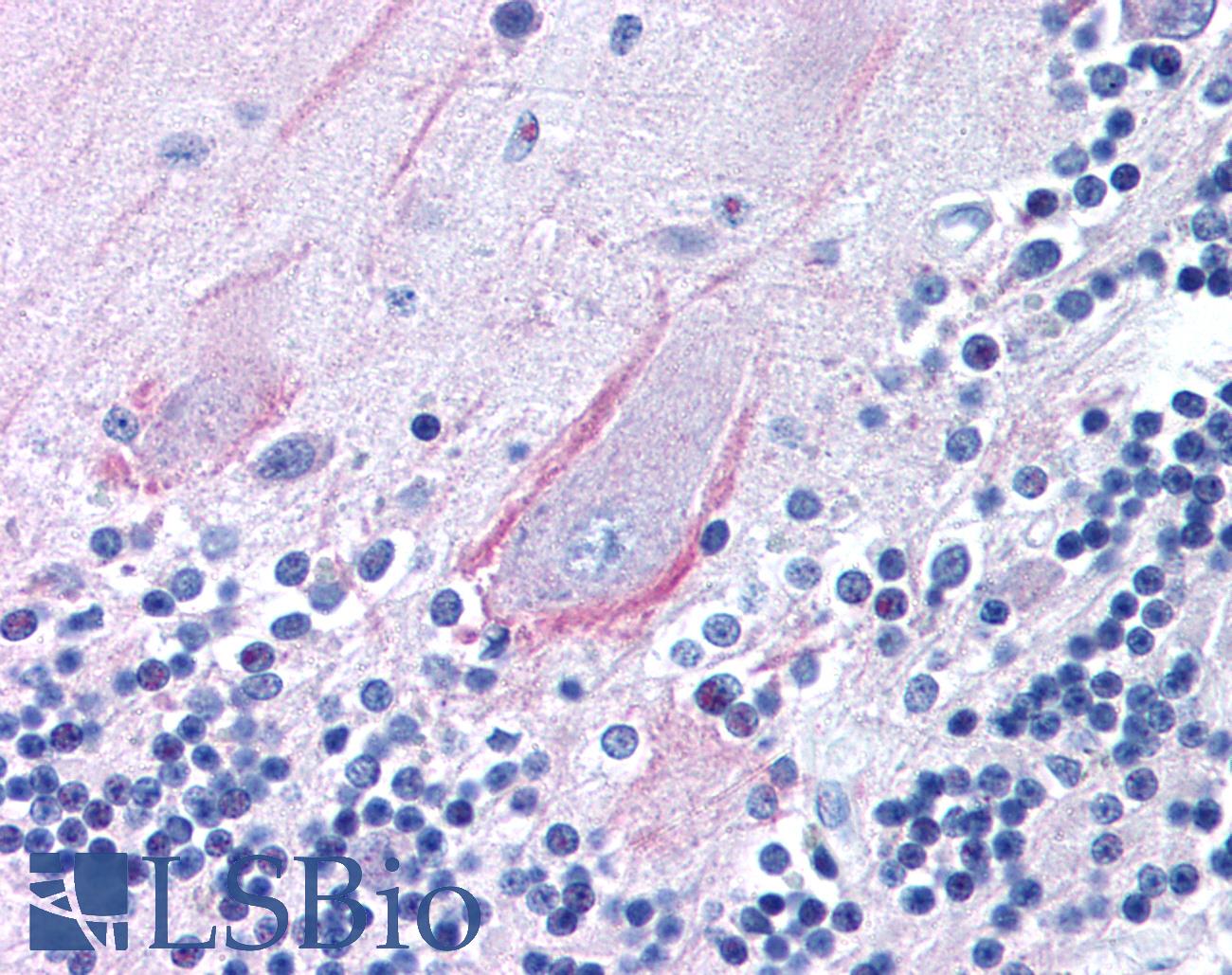 TRPA1 Antibody - TRPA1 antibody (5 ug/ml) was used in IHC to stain formalin-fixed, paraffin-embedded human brain, cerebellum, followed by biotinylated goat anti-rabbit IgG secondary antibody, alkaline phosphatase-streptavidin and chromogen.  This image was taken for the unconjugated form of this product. Other forms have not been tested.
