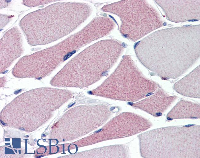 TRPA1 Antibody - TRPA1 antibody (5 ug/ml) was used in IHC to stain formalin-fixed, paraffin-embedded human skeletal muscle, followed by biotinylated goat anti-rabbit IgG secondary antibody, alkaline phosphatase-streptavidin and chromogen.