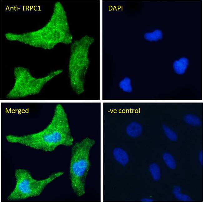 TRPC1 Antibody - TRPC1 antibody immunofluorescence analysis of paraformaldehyde fixed HeLa cells, permeabilized with 0.15% Triton. Primary incubation 1hr (10ug/ml) followed by Alexa Fluor 488 secondary antibody (4ug/ml), showing cytoplasmic/Vesicle staining. The nuclear stain is DAPI (blue). Negative control: Unimmunized goat IgG (10ug/ml) followed by Alexa Fluor 488 secondary antibody (2ug/ml).