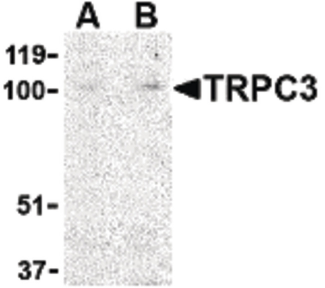 TRPC3 Antibody - Western blot of TRPC3 in mouse heart tissue lysate with TRPC3 antibody at (A) 1 and (B) 2 ug/ml.