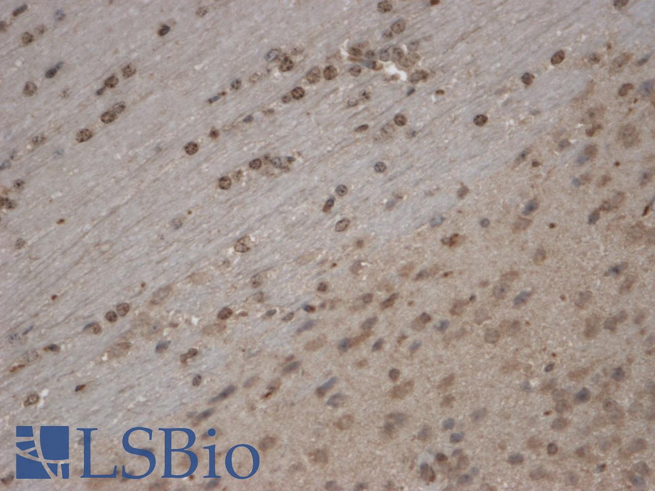 TRPC5 Antibody - IHC analysis of TrpC5 tested on mouse brain using a dilution of TRPC5 antibody. Nuclear membrane staining of every cells.  This image was taken for the unconjugated form of this product. Other forms have not been tested.