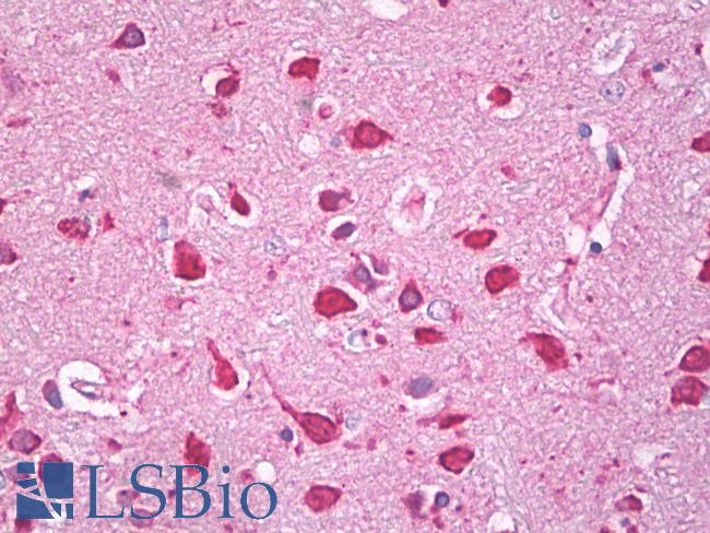 TRPC5 Antibody - Anti-TRPC5 antibody IHC of human brain, cortex. Immunohistochemistry of formalin-fixed, paraffin-embedded tissue after heat-induced antigen retrieval. Antibody dilution 5 ug/ml.  This image was taken for the unconjugated form of this product. Other forms have not been tested.