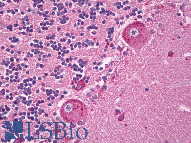 TRPC5 Antibody - Anti-TRPC5 antibody IHC of human brain, cerebellum. Immunohistochemistry of formalin-fixed, paraffin-embedded tissue after heat-induced antigen retrieval. Antibody dilution 5 ug/ml.  This image was taken for the unconjugated form of this product. Other forms have not been tested.