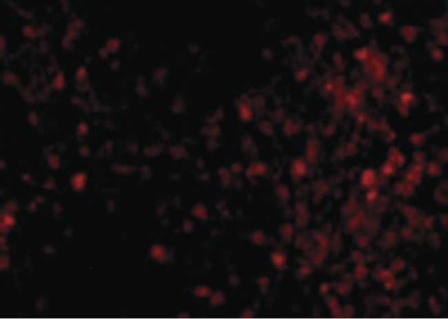 TRPC6 Antibody - Immunofluorescence of TRPC6 in Mouse Lung cells with TRPC6 antibody at 20 ug/ml.