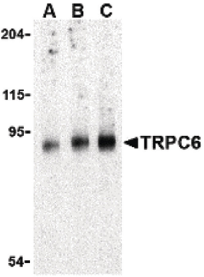 TRPC6 Antibody - Western blot of TRPC6 in mouse lung tissue lysate with TRPC6 antibody at (A) 0.5, (B) 1 and (C) 2 ug/ml.