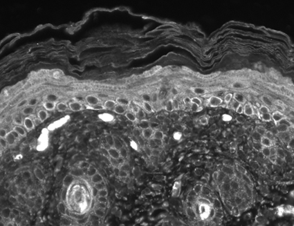 TRPC7 Antibody - IF analysis of TrpC7 in mouse back skin sections using a dilution of TRPC7 antibody.  This image was taken for the unconjugated form of this product. Other forms have not been tested.