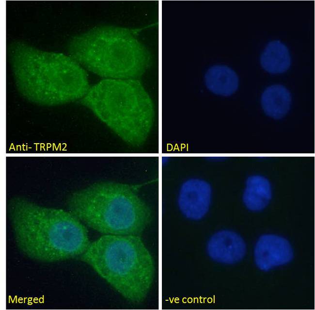 TRPM2 Antibody - TRPM2 antibody immunofluorescence analysis of paraformaldehyde fixed A431 cells, permeabilized with 0.15% Triton. Primary incubation 1hr (10ug/ml) followed by Alexa Fluor 488 secondary antibody (2ug/ml), showing vesicle staining. The nuclear stain is DAPI (blue).