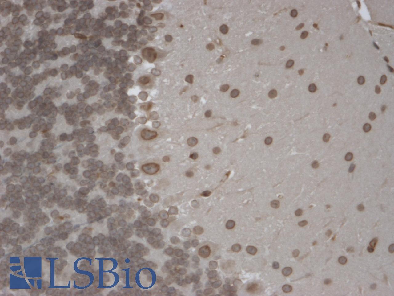 TRPM7 Antibody - IHC analysis of TrpM7 tested on mouse brain using a dilution of TRPM7 antibody. Strong positivity of the nuclear membrane of every cell.  This image was taken for the unconjugated form of this product. Other forms have not been tested.