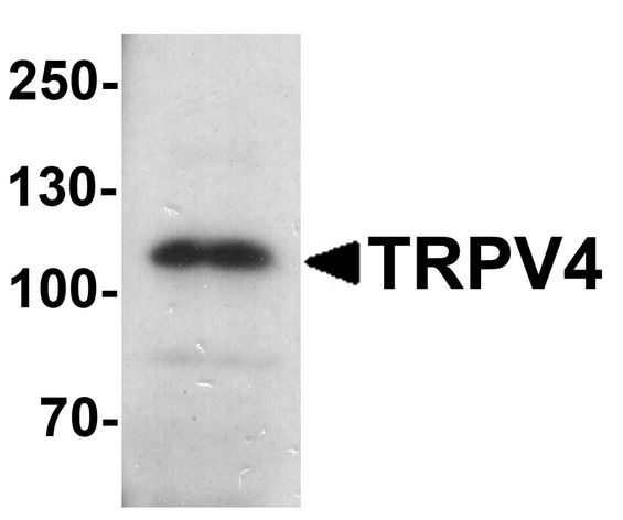 TRPV4 Antibody - Western blot analysis of TRPV4 in human testis tissue lysate with TRPV4 antibody at 1 ug/ml.