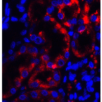 TRPV4 Antibody - Immunofluorescence of TRPV4 in human kidney tissue with TRPV4 antibody at 5 µg/ml.
