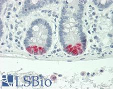 Trypsin Antibody - Human Small Intestine: Formalin-Fixed, Paraffin-Embedded (FFPE)
