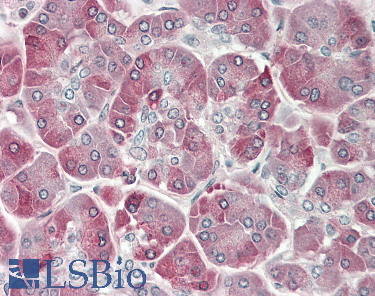 Trypsin Antibody - Human Pancreas: Formalin-Fixed, Paraffin-Embedded (FFPE)