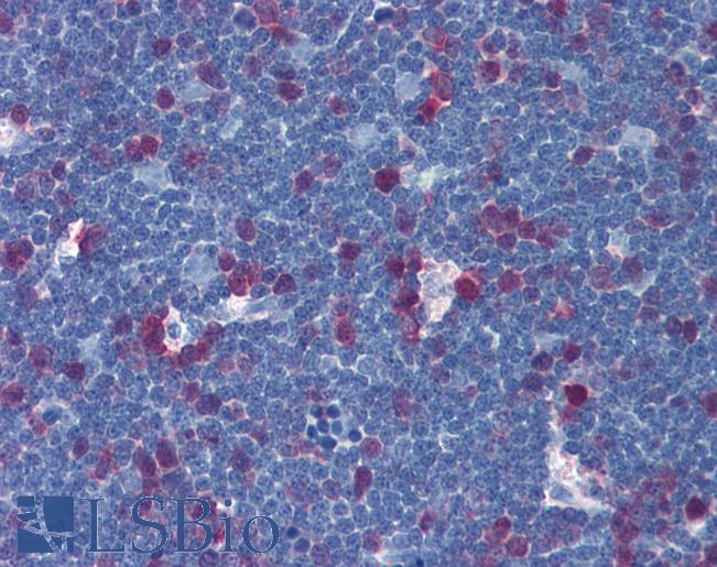 TS / Thymidylate Synthase Antibody - Anti-TYMS antibody IHC of human thymus. Immunohistochemistry of formalin-fixed, paraffin-embedded tissue after heat-induced antigen retrieval. Antibody concentration 5 ug/ml.