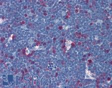 TS / Thymidylate Synthase Antibody - Anti-TYMS antibody IHC of human thymus. Immunohistochemistry of formalin-fixed, paraffin-embedded tissue after heat-induced antigen retrieval. Antibody concentration 5 ug/ml.