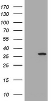 TS / Thymidylate Synthase Antibody - HEK293T cells were transfected with the pCMV6-ENTRY control (Left lane) or pCMV6-ENTRY TYMS(Right lane) cDNA for 48 hrs and lysed. Equivalent amounts of cell lysates (5 ug per lane) were separated by SDS-PAGE and immunoblotted with anti-TYMS.