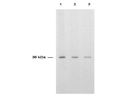 TS / Thymidylate Synthase Antibody - Anti-Thymidylate Synthase Antibody - Western Blot. Anti-TS is shown to detect thymidylate synthase present in a HeLa cell extract. Each lane is estimated to contain 4 ug of protein. Lanes 1, 2 and 3 represent 1:2000, 1:5000 and 1:10000 fold dilutions of the antibody. Detection was made using HRP Rabbit-a-Sheep IgG (LS-C61113) diluted 1:1000 and color development using TMB (TMBM-100) substrate for approximately 4.