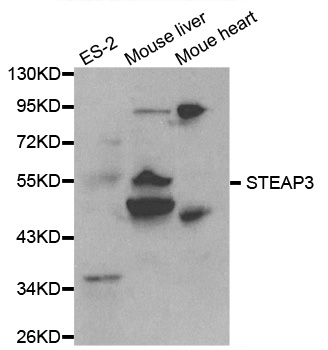 TSAP6 / STEAP3 Antibody - Western blot analysis of extracts of various cell lines, using STEAP3 antibody at 1:1000 dilution. The secondary antibody used was an HRP Goat Anti-Rabbit IgG (H+L) at 1:10000 dilution. Lysates were loaded 25ug per lane and 3% nonfat dry milk in TBST was used for blocking.